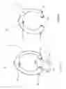 Fig. 02 - Iris retraction balloon for phacoemulsification
