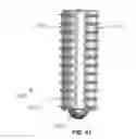 Fig. 40 - KNOTLESS SUTURE ANCHOR FOR SECURING SOFT TISSUE TO BONE