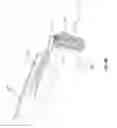 Fig. 67 - KNOTLESS SUTURE ANCHOR FOR SECURING SOFT TISSUE TO BONE