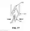 Fig. 76 - KNOTLESS SUTURE ANCHOR FOR SECURING SOFT TISSUE TO BONE