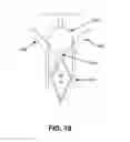 Fig. 77 - KNOTLESS SUTURE ANCHOR FOR SECURING SOFT TISSUE TO BONE