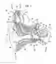 Fig. 02 - Configuration of implanted devices