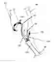 Fig. 01 - Endovascular electrostimulation near a carotid bifurcation in treating cerebrovascular conditions