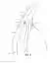 Fig. 02 - Intraocular implants and related kits and methods