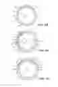 Fig. 06 - Intraocular implants and related kits and methods
