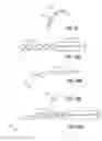Fig. 44 - Intraocular implants and related kits and methods