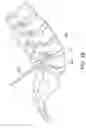 Fig. 09 - Spinal Implant