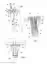 Fig. 02 - MODULAR BONE IMPLANT, TOOLS, AND METHOD