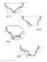 Fig. 04 - ESOPHAGEAL VALVE