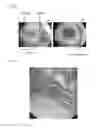 Fig. 04 - TRANSPLANTATION DEVICE