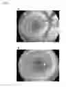 Fig. 07 - TRANSPLANTATION DEVICE