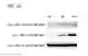 Fig. 16 - Method and kit for evaluation of predisposition to development of obesity, anti-obesity agent and method for screening thereof, non-human animal, adipose tissue, adipocyte, method for production of transgenic mouse, antigen, and antibody