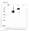 Fig. 15 - Method for secretory production of glycoprotein having human-type sugar chain using plant cell