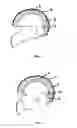Fig. 02 - Protective helmet; Method for mitigating or preventing a head injury