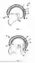 Fig. 06 - Protective helmet; Method for mitigating or preventing a head injury