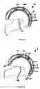 Fig. 09 - Protective helmet; Method for mitigating or preventing a head injury