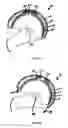 Fig. 10 - Protective helmet; Method for mitigating or preventing a head injury