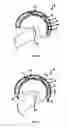 Fig. 11 - Protective helmet; Method for mitigating or preventing a head injury