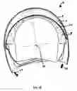 Fig. 14 - Protective helmet; Method for mitigating or preventing a head injury