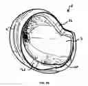 Fig. 20 - Protective helmet; Method for mitigating or preventing a head injury