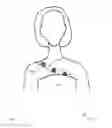 Fig. 02 - SYSTEMS, METHODS AND APPARATUS FOR APPAREL STRAPS