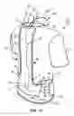 Fig. 20 - Pocketed garment