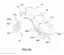 Fig. 10 - Face mask and goggle system