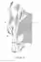 Fig. 05 - Upper body protective garment
