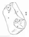 Fig. 14 - METHODS FOR USING HEAD POSITIONING PILLOWS TO OPTIMIZE RESPIRATORY TITRATION