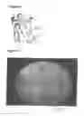 Fig. 05 - Anti-decubitus cushion