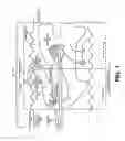 Fig. 02 - Adjusting a position of a heating wire within a breathing circuit