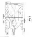 Fig. 05 - Adjusting a position of a heating wire within a breathing circuit
