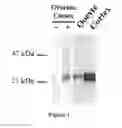 Fig. 02 - Progesterone receptor membrane component 1 (PGRMC1) as an indicator of fertility in animals