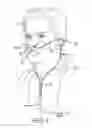 Fig. 02 - COMPLIANT NASAL CANNULA