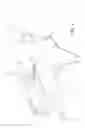 Fig. 02 - Hiccup Relief Device and Method