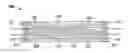 Fig. 01 - Neutron detector having enhanced absorption and bifurcated detection elements
