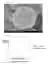 Fig. 04 - FUNCTIONAL PARTICLE WITH ROUGH-SURFACED POLYMER COATING