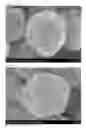 Fig. 07 - FUNCTIONAL PARTICLE WITH ROUGH-SURFACED POLYMER COATING