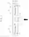 Fig. 03 - MOLDING APPARATUS AND MOLDING METHOD FOR PACKAGING SEMICONDUCTOR