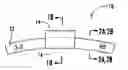 Fig. 01 - Vehicle wheel balance weights