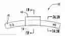Fig. 01 - VEHICLE WHEEL BALANCE WEIGHTS