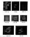 Fig. 07 - Method for magnetic resonance imaging using inversion recovery with on-resonant water suppression including MRI systems and software embodying same