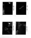 Fig. 08 - Method for magnetic resonance imaging using inversion recovery with on-resonant water suppression including MRI systems and software embodying same
