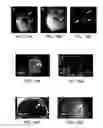 Fig. 13 - Method for magnetic resonance imaging using inversion recovery with on-resonant water suppression including MRI systems and software embodying same