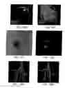 Fig. 14 - Method for magnetic resonance imaging using inversion recovery with on-resonant water suppression including MRI systems and software embodying same