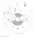 Fig. 06 - Contact lens and method of manufacture