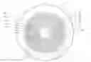 Fig. 01 - Method and system for retarding the progression of myopia