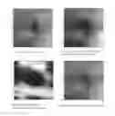 Fig. 05 - Method for finding the lateral position of the fovea in an SDOCT image volume