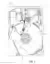 Fig. 02 - Transducing head writer having write pole bridge feature, and devices thereof