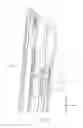 Fig. 07 - Panel fixing mechanism and displaying device thereof